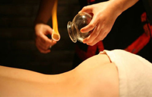 Cupping Therapy